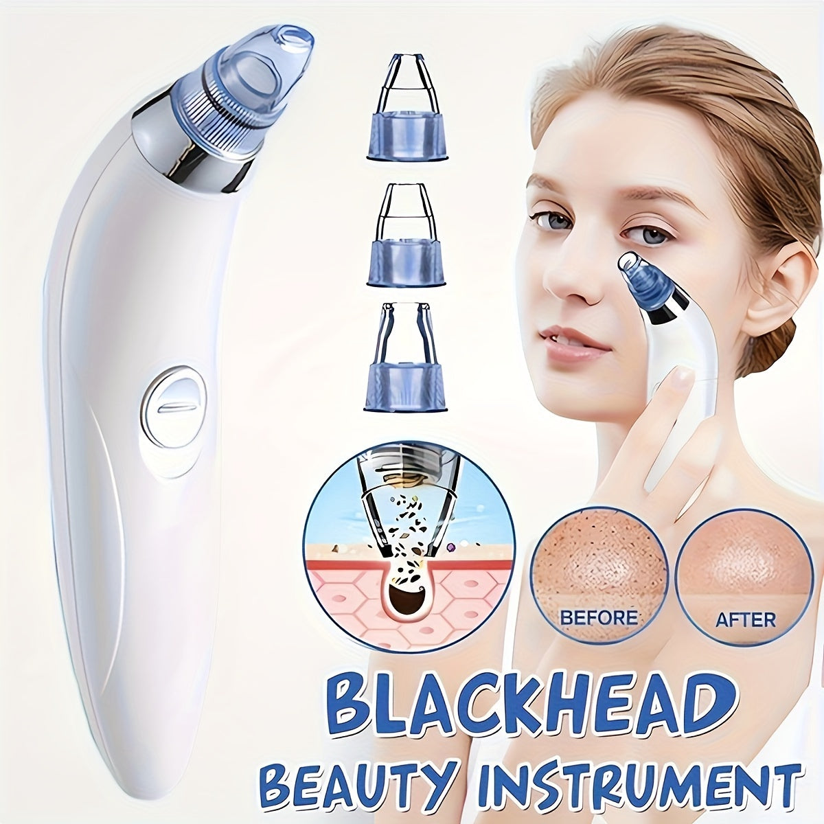 Portable Blackhead Vacuum Remover ()
